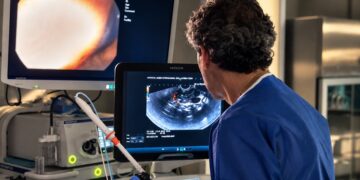 Una técnica mínimamente invasiva permite destruir un tumor de páncreas